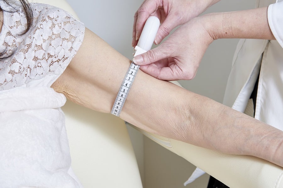 リンパ浮腫手術前の計測_上肢