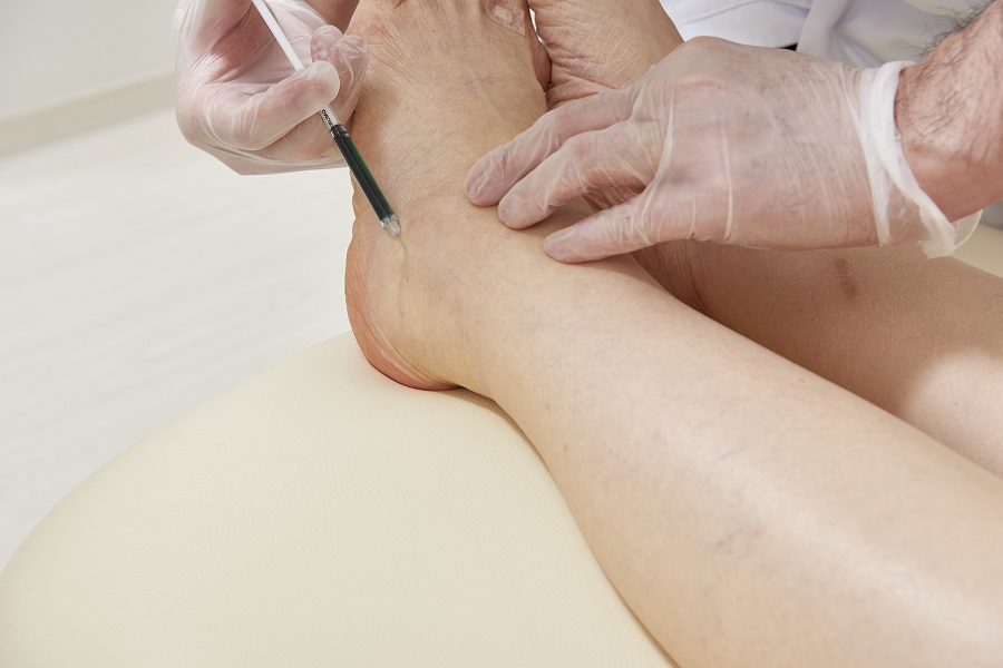 IGCリンパ管造影：撮影しているところ_下肢_2