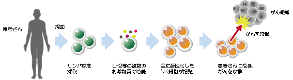 NK細胞療法とは
