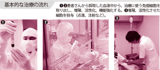 治療の流れ・治療の安全性