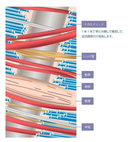 ナガオメソッド治療イメージ