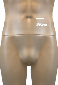 顕微鏡下高位結紮術イメージ