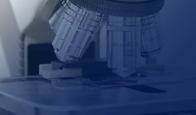 精液所見の悪化