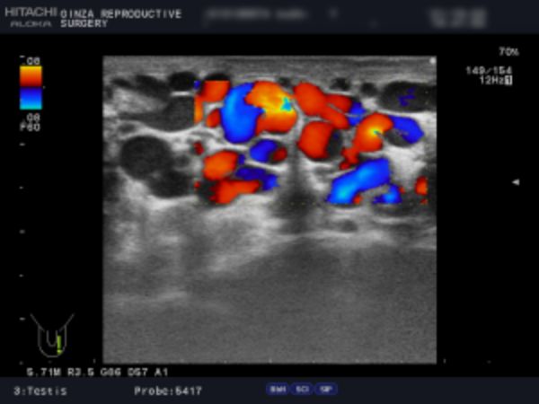 例1：左側２画面のエコー検査の画像 ２枚目