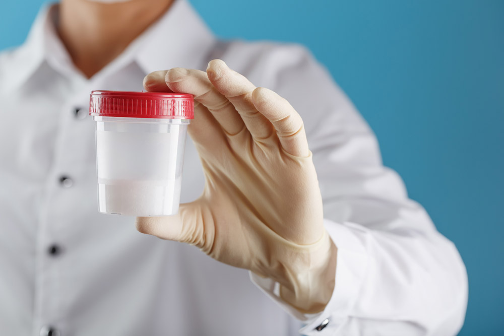 精液検査の結果はどう見たらよい？不妊治療に影響のある数値