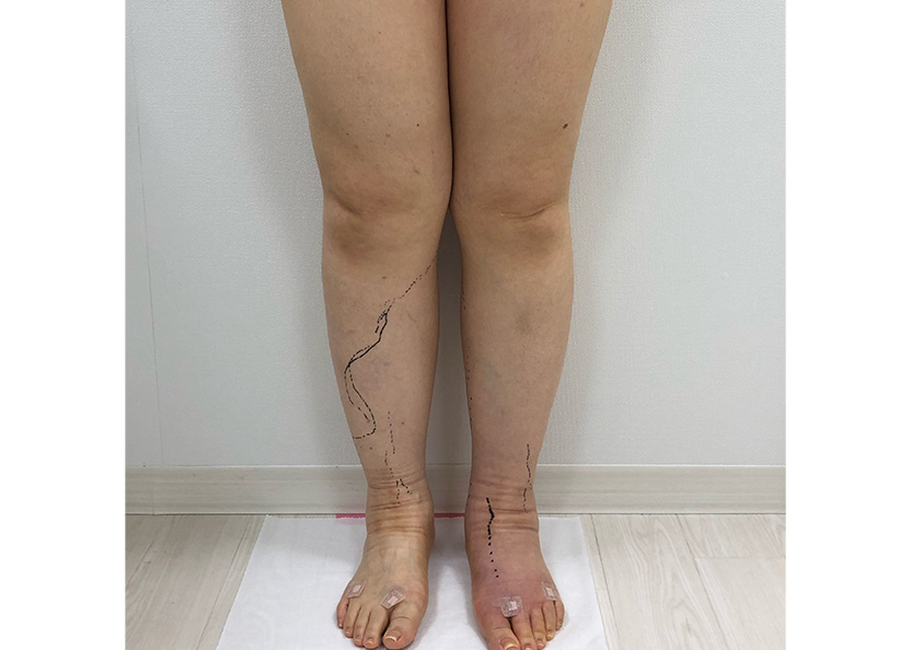 術前前方からのお写真