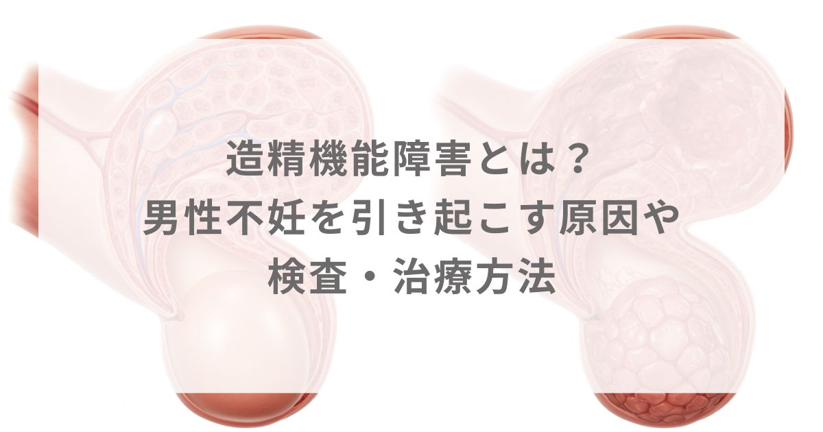 造精機能障害とは？男性不妊を引き起こす原因や検査・治療方法